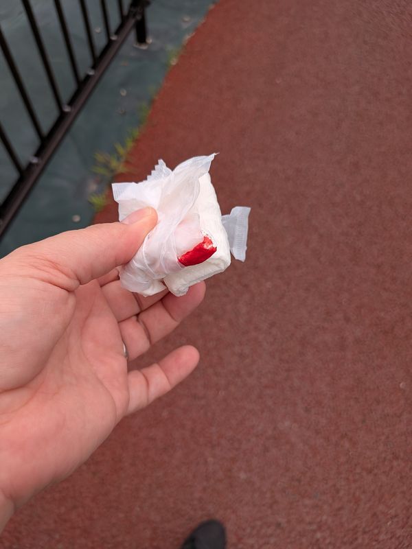 Always Carry Wet Wipes (and Bandages) photo