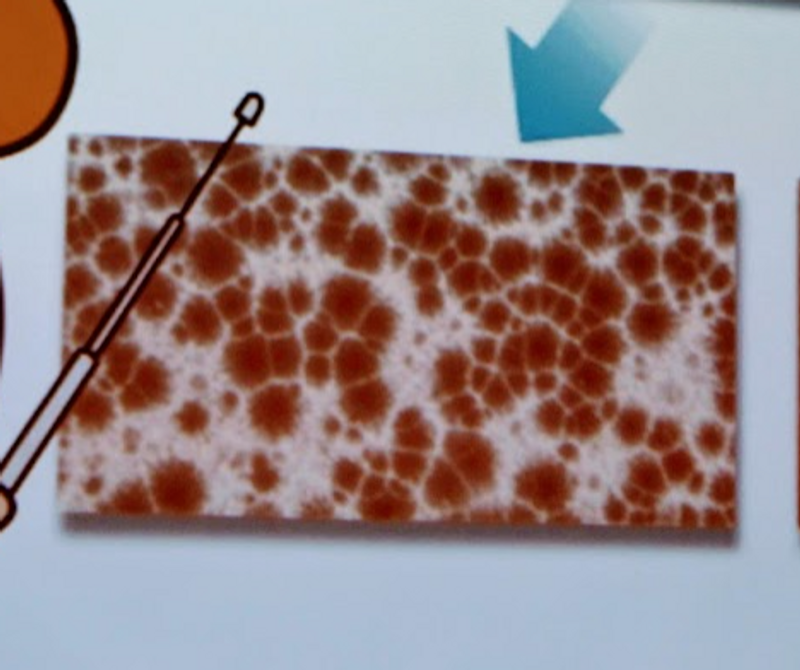 The use of penicillin in Japan photo