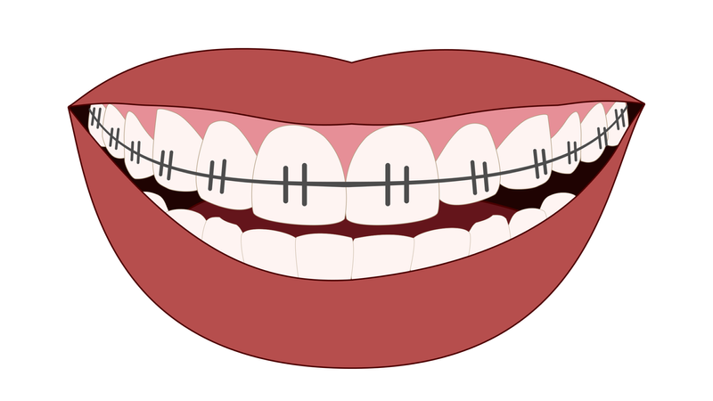 The money side of straight teeth in Japan photo